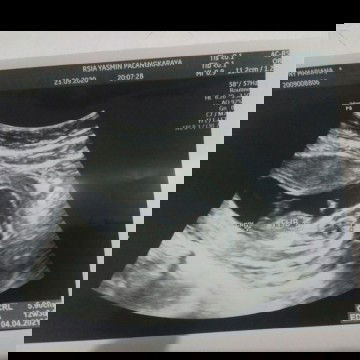 hamil muda dan anak pertama