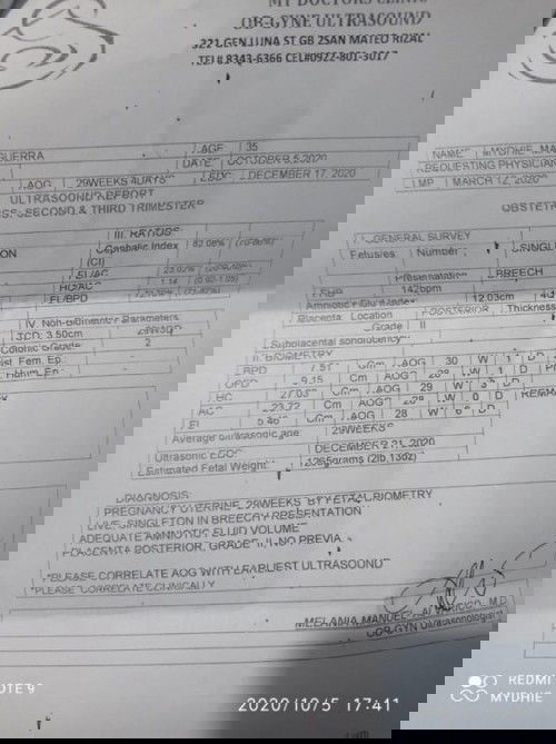 Breech po c baby may chance pa po ba umikot