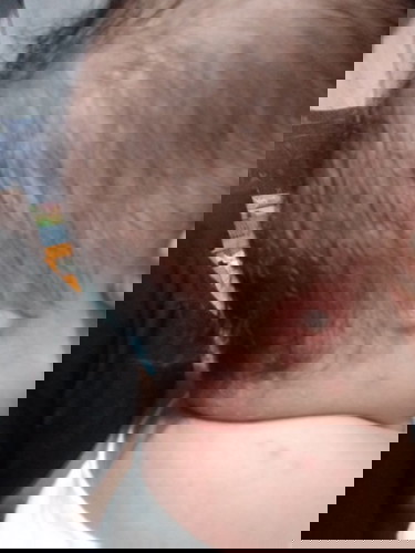 May Tumutubo Bigla Kay Baby..