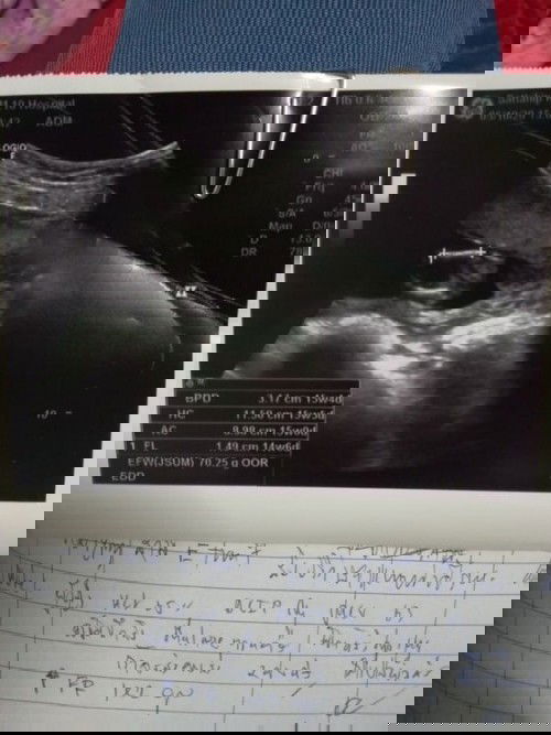 กังวลจังเลยค่ะ