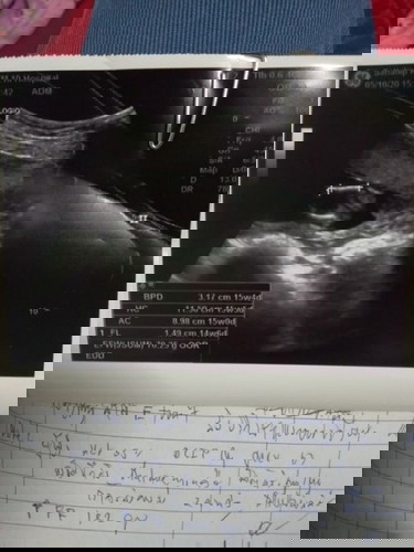 กังวลจังเลยค่ะ