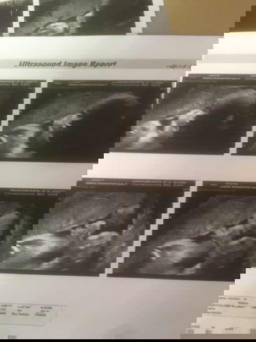 น้ำหนักน้องตอน31 week