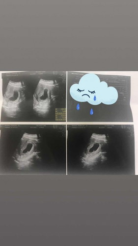อาจเกิดภาวะไข่ฝ่อ น้ำตาไหลเลยคะ😢