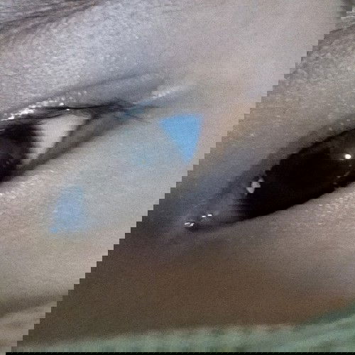 Mata bayi pinggir bola mata putih