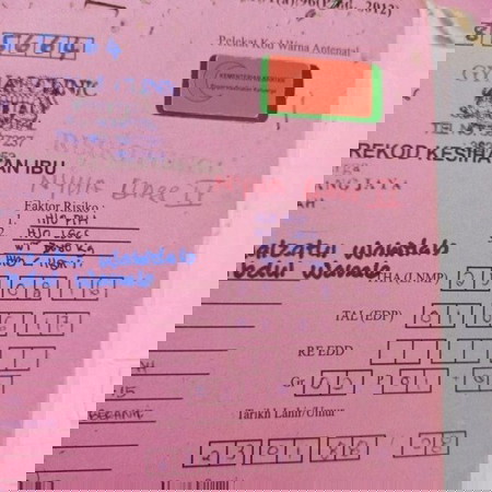 PENGALAMAN SAYA : EDEMA ATAU PRE ECLAMPSIA