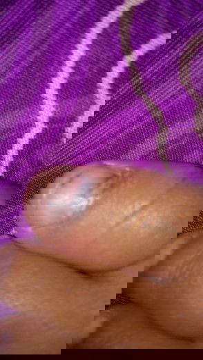 kuku jari jempol biru