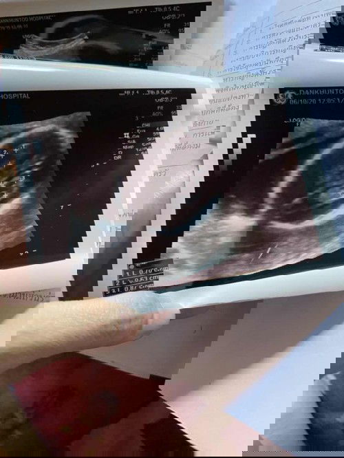 เครียดมากเลยค่ะ