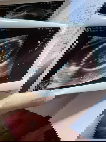 เครียดมากเลยค่ะ