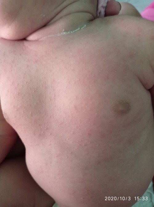 OBAT PALING AMPUH UTK GATAL" PADA BAYI 1BULAN
