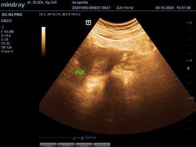 Usia 5w belum kelihatan