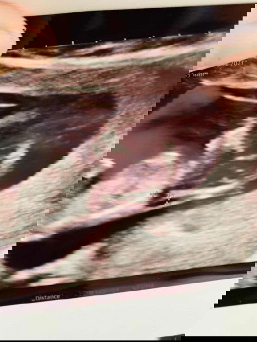 ช่วยวิเคราะห์หน่อยค่ะ