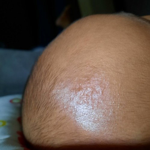 Kulit kepala