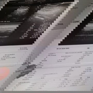 My Due date is December 24