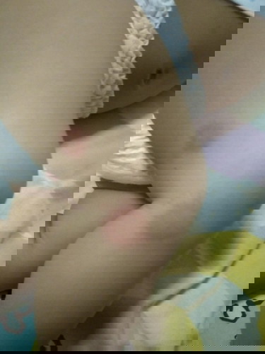 น้องเหมือนโดนอะไรกัดแล้วแพ้ มียาตัวไหนสามารถทาได้บ้างคะ #น้อง6m23d.