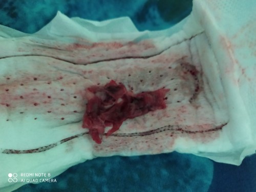 แท้งรึป่าวค่ะ