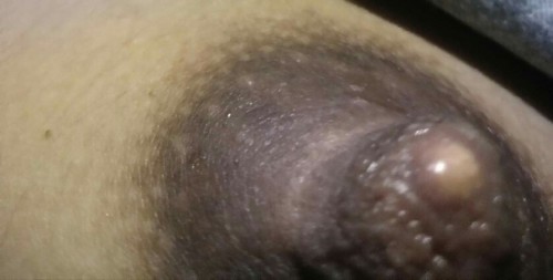 แบบนี้เรียกไวท์ดอทหรือป่าวค่ะ