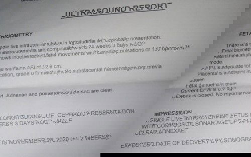 My ultrasound Result