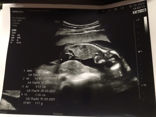 15wแล้วจ้า ลูกสาวค่า👶🏻