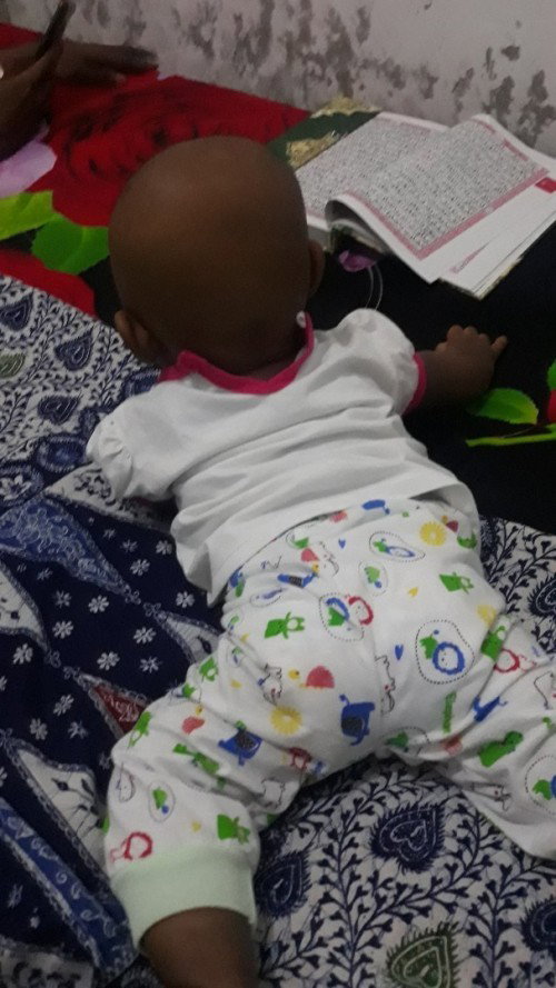 Bayi 9 bulan belum bisa merangkak dan duduk