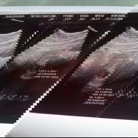 ขอดูรูปซาวด์แม่ๆ 2เดือนกว่าๆหน่อยค่ะ❤