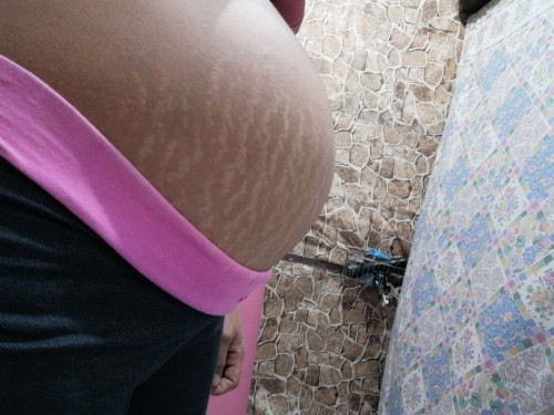 Sobra tulis at syempre strech mark 😊😅. Mga mommy sa tingin nyu boy or girl po😍