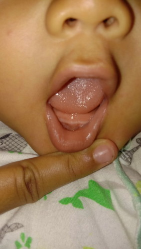 tumbuh gigi