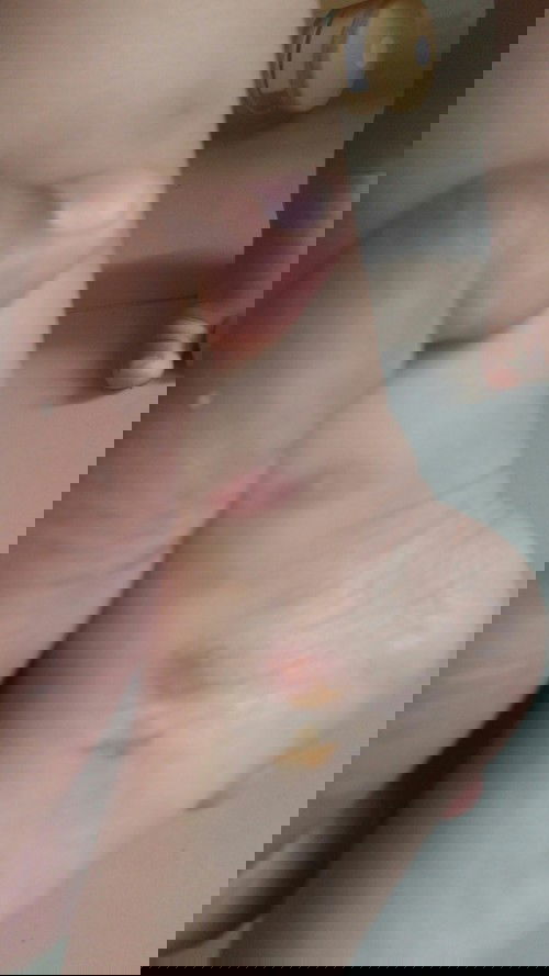 bentol digigit nyamuk tahan lama