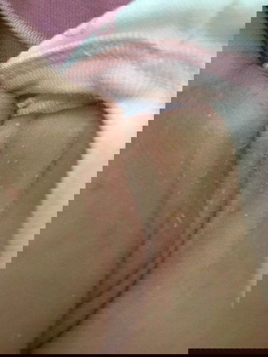 สีเหลืองๆที่คอน้องคืออะไรหรอค่ะ