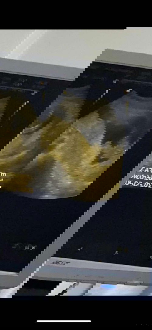 ช่วยดูเพศหน่อยค่ะ