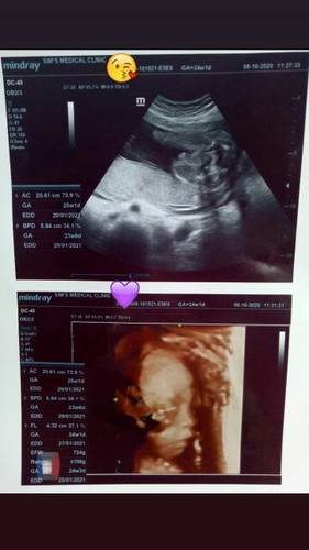 Scan 24w 😊