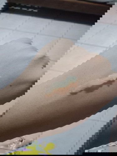 White discharge