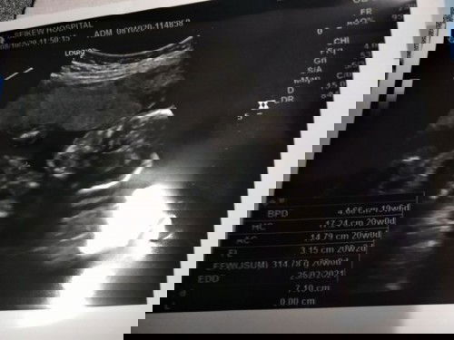 อัตราซาวด์ 19วีค