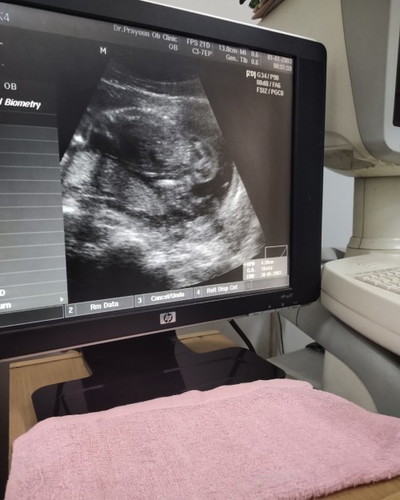 เพศของลูกในท้อง