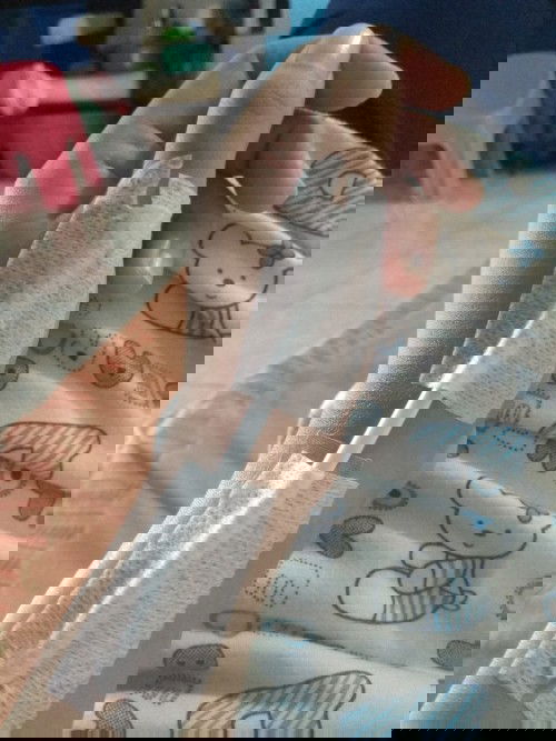 de quervain syndrome