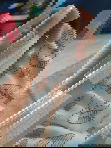 de quervain syndrome