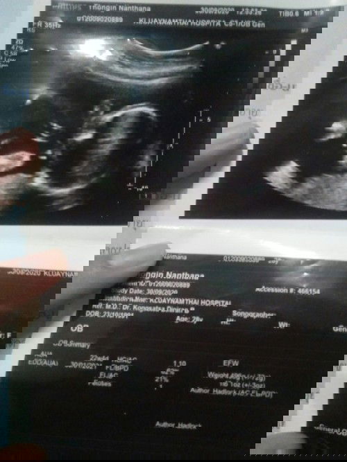 แม่ๆคะ..ใครพอทราบบ้างไหมคะ. ในใบซาวน์เรา Gender F??(ได้เพศหญิงใช่ปะคะ😊😊)