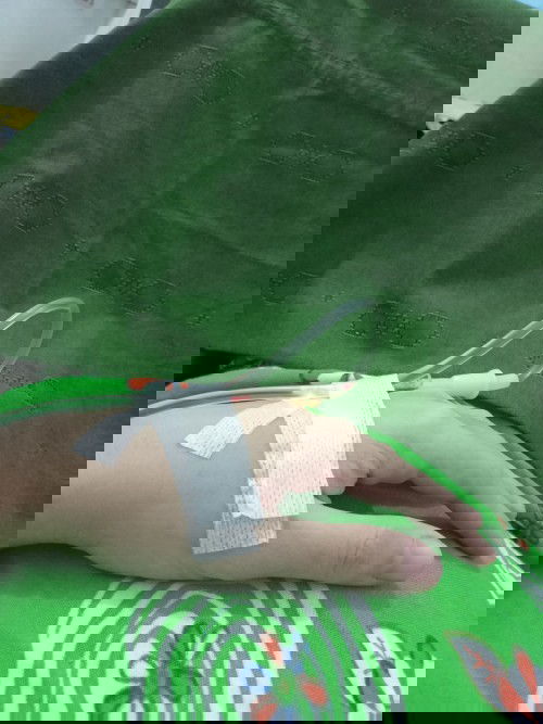 Melahirkan usia kandungan 32minggu.