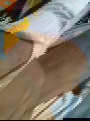 Rashes po kaya ito kinakabahan na po kase ako dumadami na sya😔 sana po may makapansin sa tanong ko.