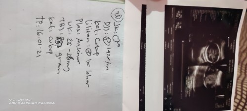 Khawatir baby prtama