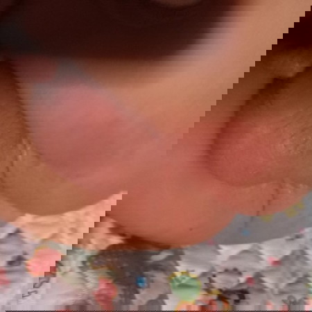 Rashes