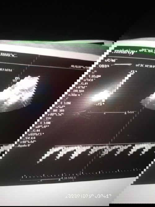 Bc hsl usg sering bun .. ..