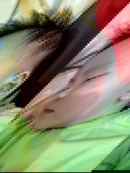 ผื่นแบบนี้ใช้อะไรทาคะ