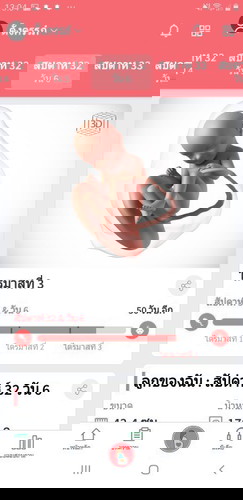 32W6d พึ่งไปซาวมาอีกรอบวันนี้หมอบอกน้องนอนขวางตัวเล็กอีกด้วยแค่1800 มีใครเป็นบ้างไหมค่ะ บำรุงยังใงดี