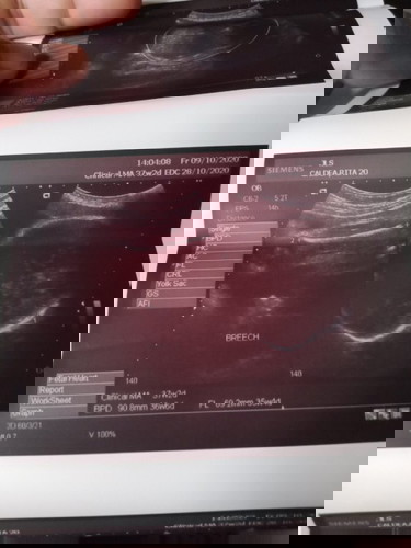 36 weeks and first time mommy here