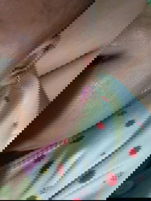 kulit wajah kena asi?