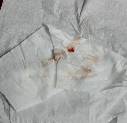 มาแบ่งปันประสบการณ์ส่วนตัวค่ะ