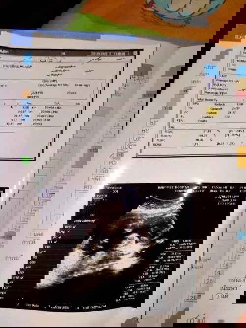 26 W มองยังไงก็มองไม่ออก 🌈