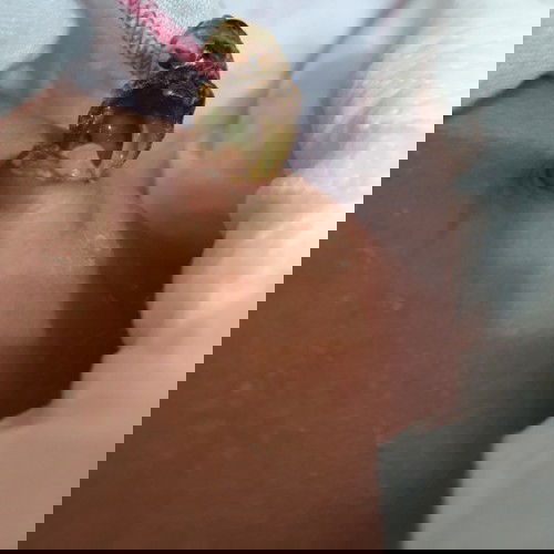 Hi mommy's, my baby 12 days old. Her umbilical code hanging and there is yellowish fluid.