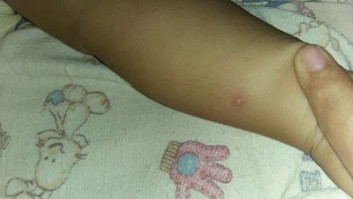 Byi ku seperti ini obat nya apa ya?? Mohon info nya bunda bunda dh berobat kmn"..tpi hasilny nihil..