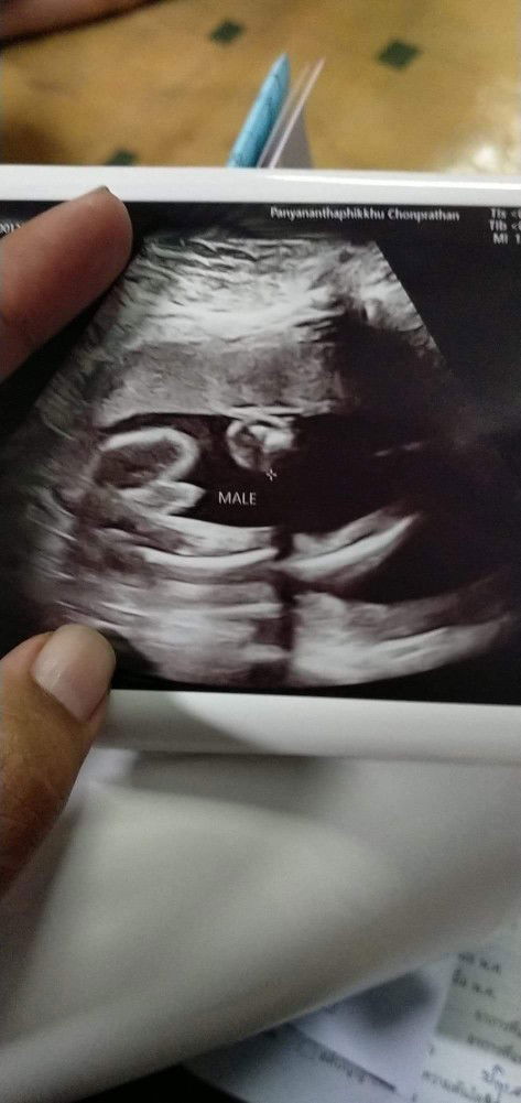 อยากรู้เพศ